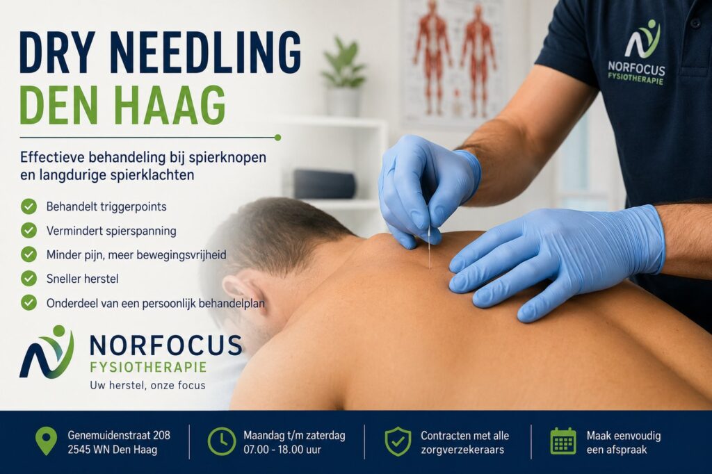 dry-needling-den-haag